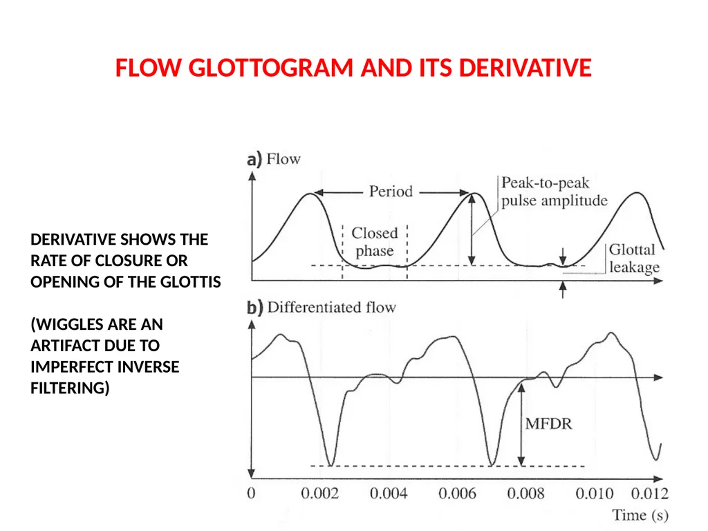 1. SPEECH PRODUCTION MUSIC 318 MINI-COURSE ON - slide 15 of 21