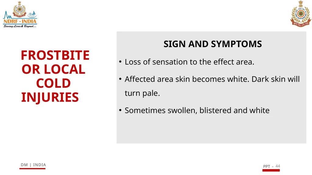 SNAKE BITE & ENVIRONMENTAL EMERGENCIES 1 Presented - slide 44 of 48