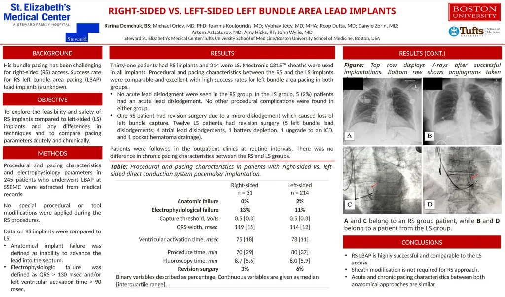 RIGHT-SIDED VS. LEFT-SIDED LEFT BUNDLE AREA LEAD - slide 1 of 12