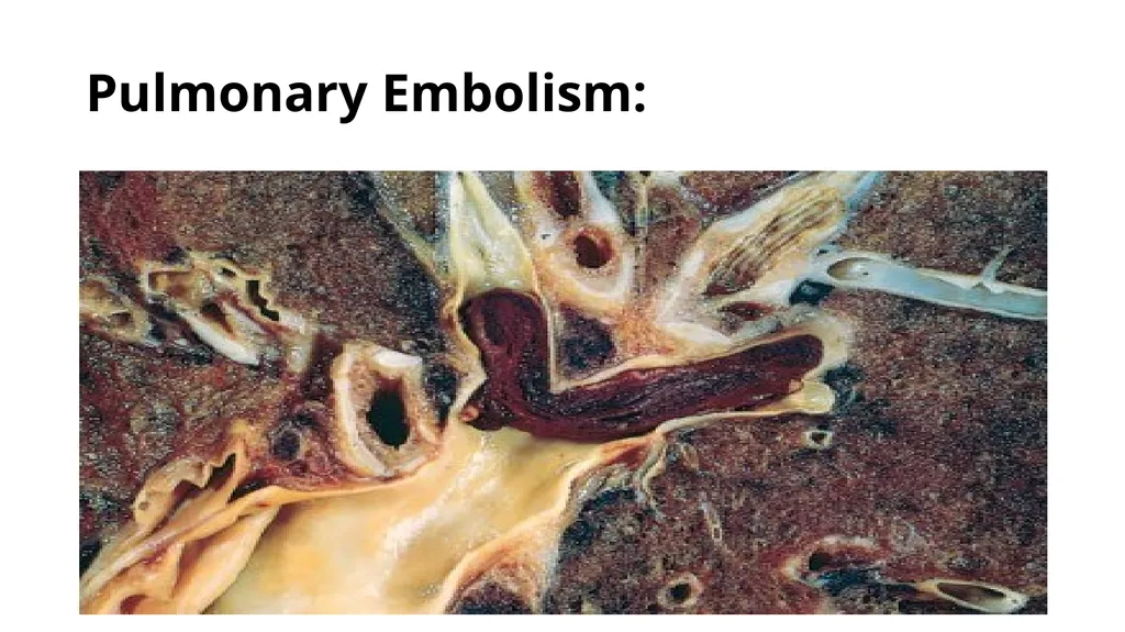 Introduction To Pathology Dr. Raya D. Marji, M.D. - slide 43 of 46