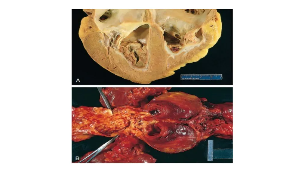 Introduction To Pathology Dr. Raya D. Marji, M.D. - slide 34 of 46