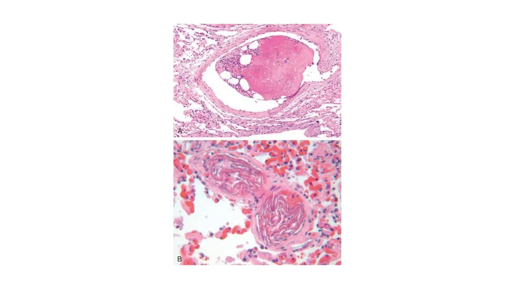 Introduction To Pathology Dr. Raya D. Marji, M.D. - slide 46 of 46