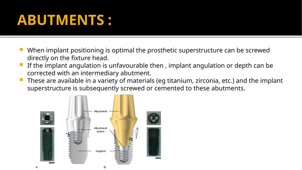 IMPRESSION IN IMPLANT DENTISTRY Presented by :Dr. - slide 16 of 38