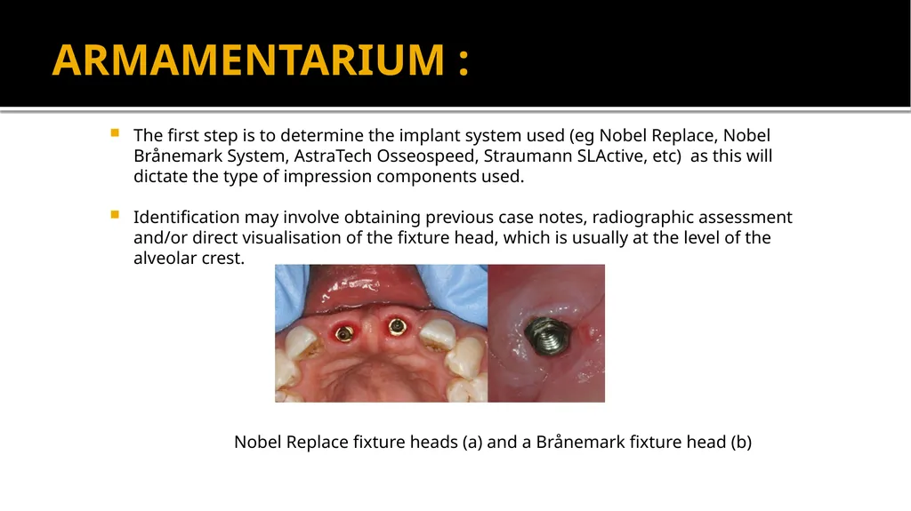 IMPRESSION IN IMPLANT DENTISTRY Presented by :Dr. - slide 5 of 38