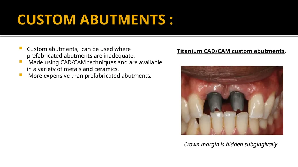 IMPRESSION IN IMPLANT DENTISTRY Presented by :Dr. - slide 21 of 38