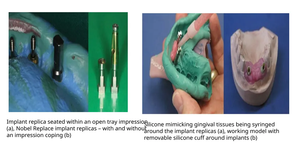IMPRESSION IN IMPLANT DENTISTRY Presented by :Dr. - slide 34 of 38
