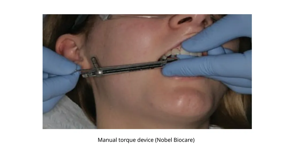 IMPRESSION IN IMPLANT DENTISTRY Presented by :Dr. - slide 10 of 38