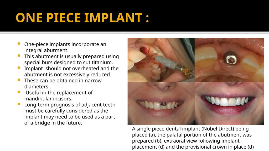 IMPRESSION IN IMPLANT DENTISTRY Presented by :Dr. - slide 22 of 38