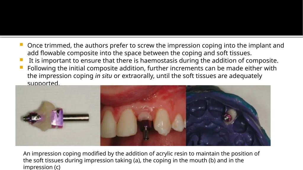IMPRESSION IN IMPLANT DENTISTRY Presented by :Dr. - slide 15 of 38