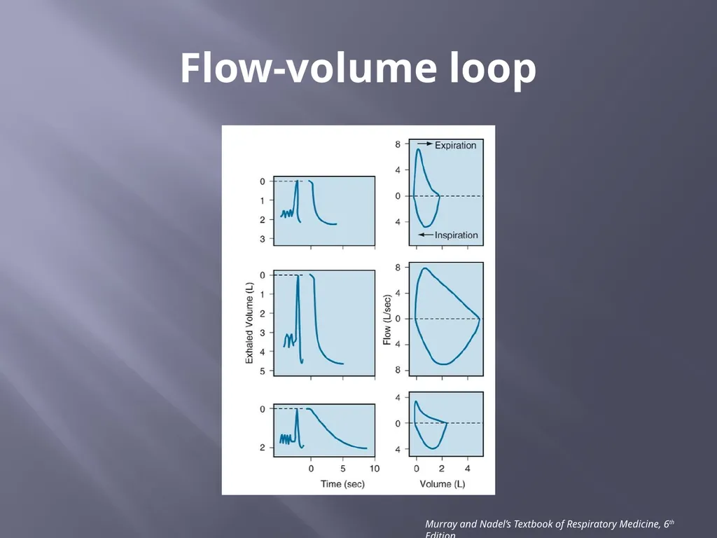 PFT Interpretation Darrin Hursey, MD Overview - slide 14 of 20