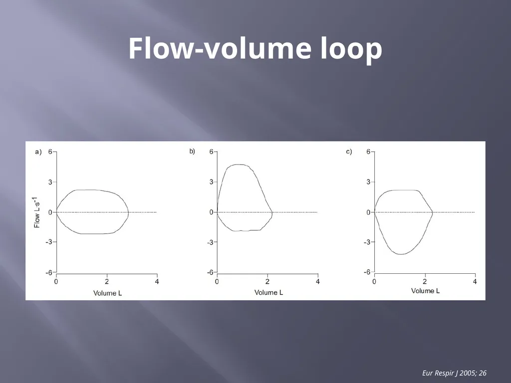 PFT Interpretation Darrin Hursey, MD Overview - slide 15 of 20