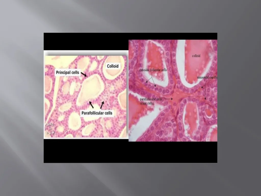 THYROID GLAND-part 1 DR. SHEETAL JAIN Thyroid - slide 13 of 18
