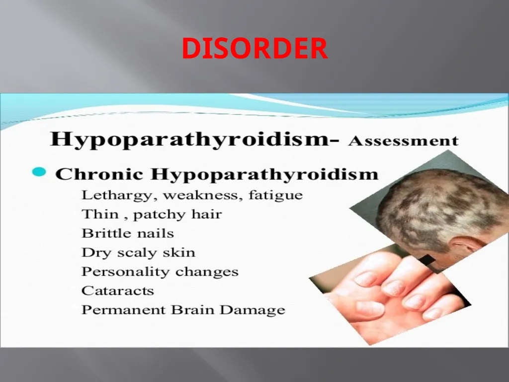 THYROID GLAND –part 3 disorders DR. SHEETAL JAIN - slide 39 of 40