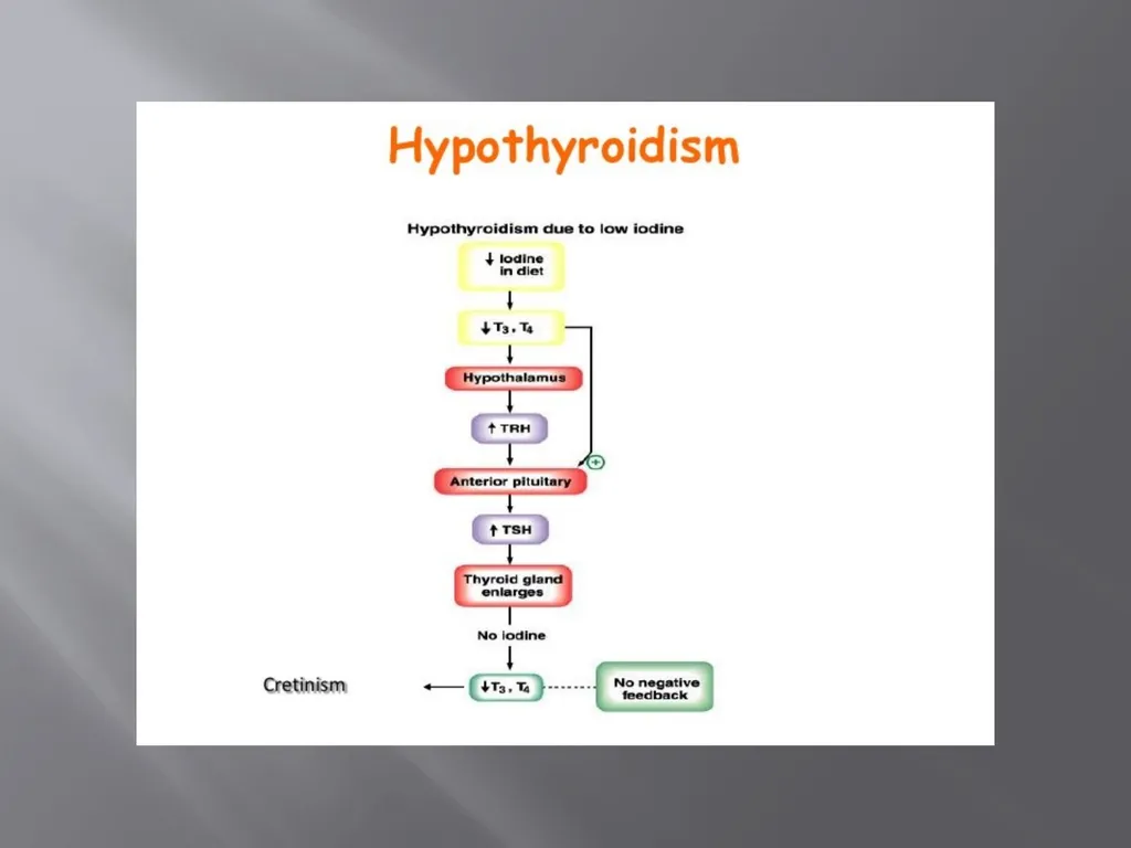 THYROID GLAND –part 3 disorders DR. SHEETAL JAIN - slide 15 of 40