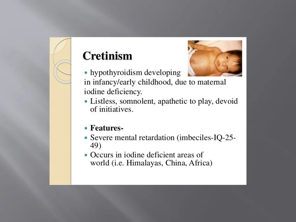 THYROID GLAND –part 3 disorders DR. SHEETAL JAIN - slide 20 of 40