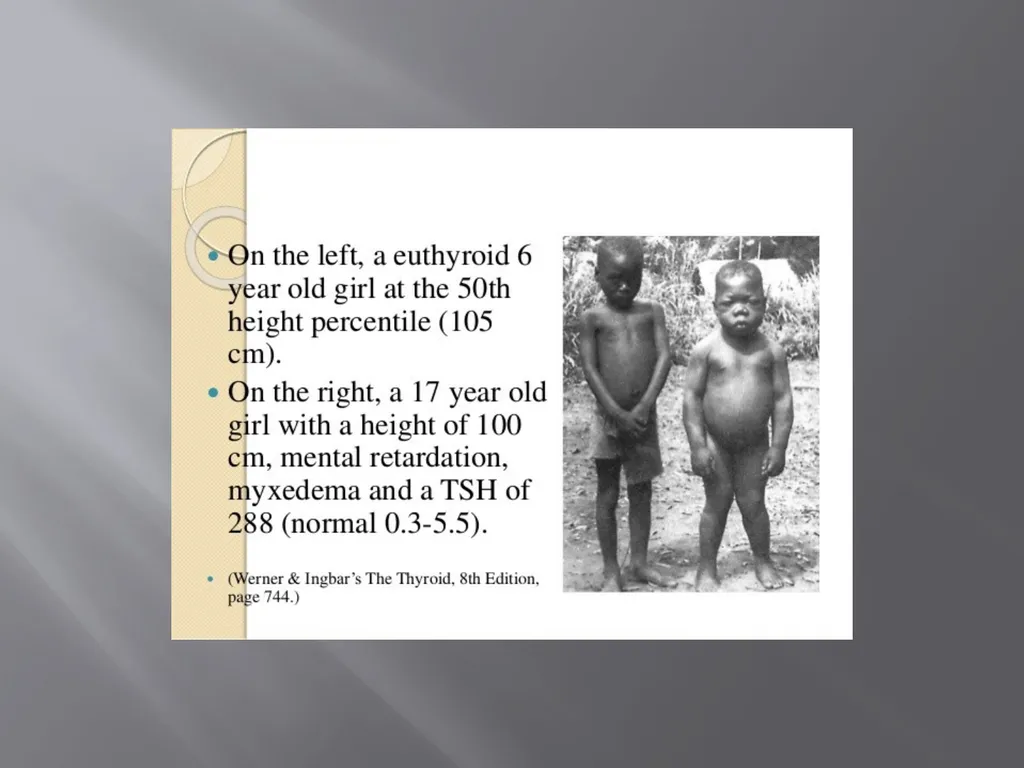THYROID GLAND –part 3 disorders DR. SHEETAL JAIN - slide 22 of 40