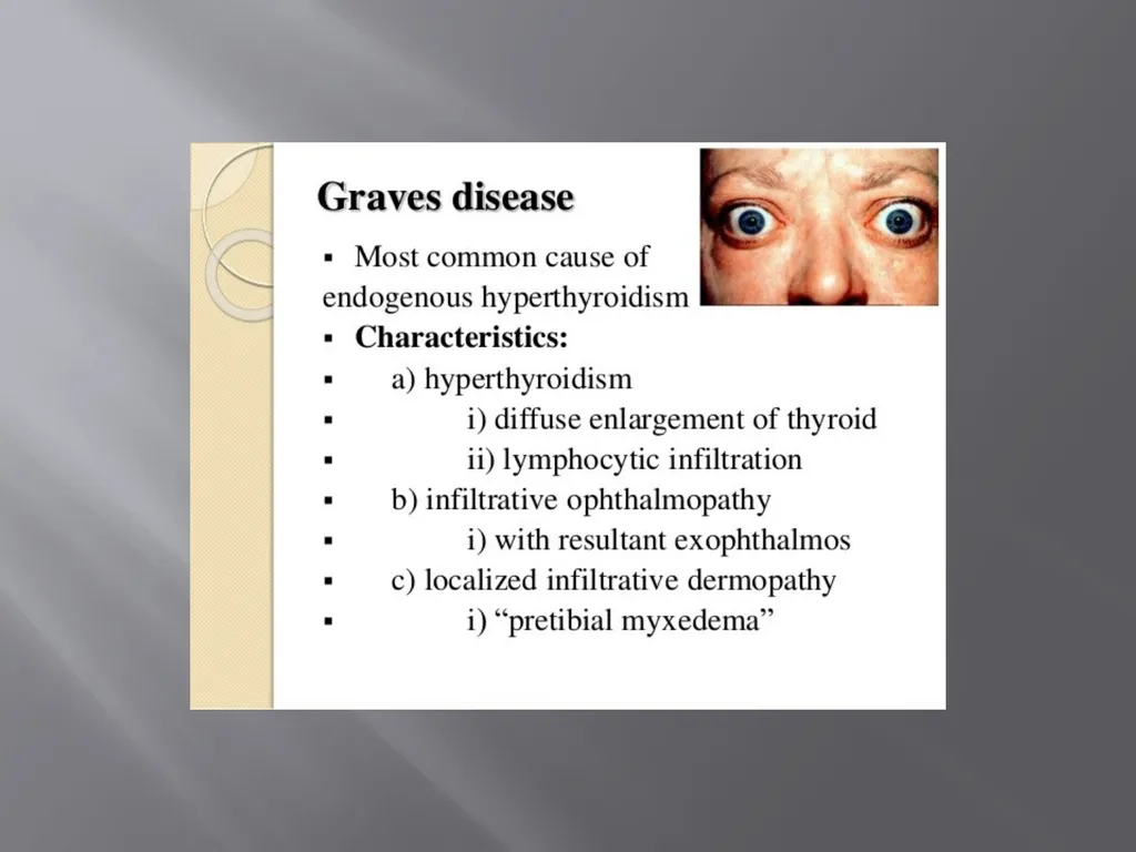 THYROID GLAND –part 3 disorders DR. SHEETAL JAIN - slide 27 of 40