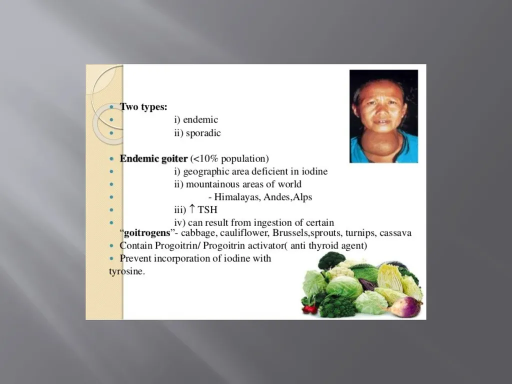 THYROID GLAND –part 3 disorders DR. SHEETAL JAIN - slide 36 of 40