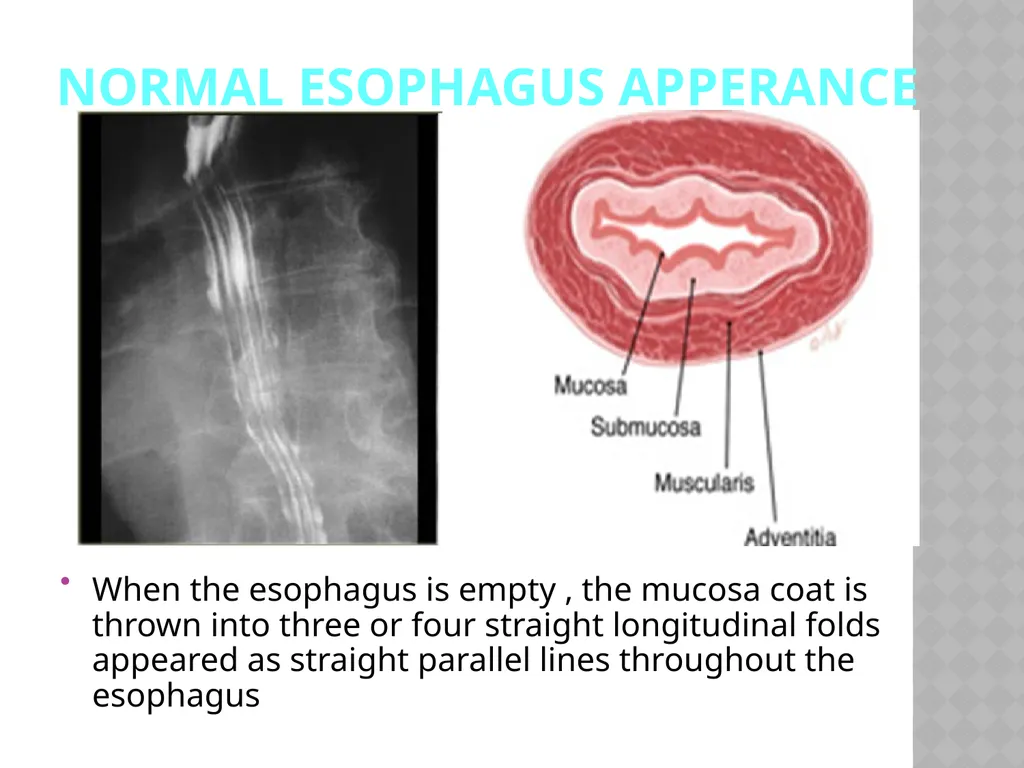 Barium Swallow Meaad AlMusined Introduction - slide 3 of 12