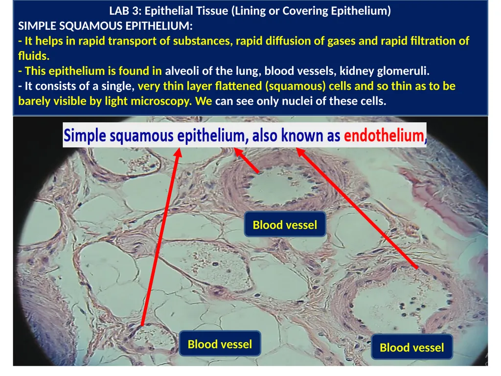 LAB 3: Covering or Lining Epithelium: Lining - slide 6 of 6