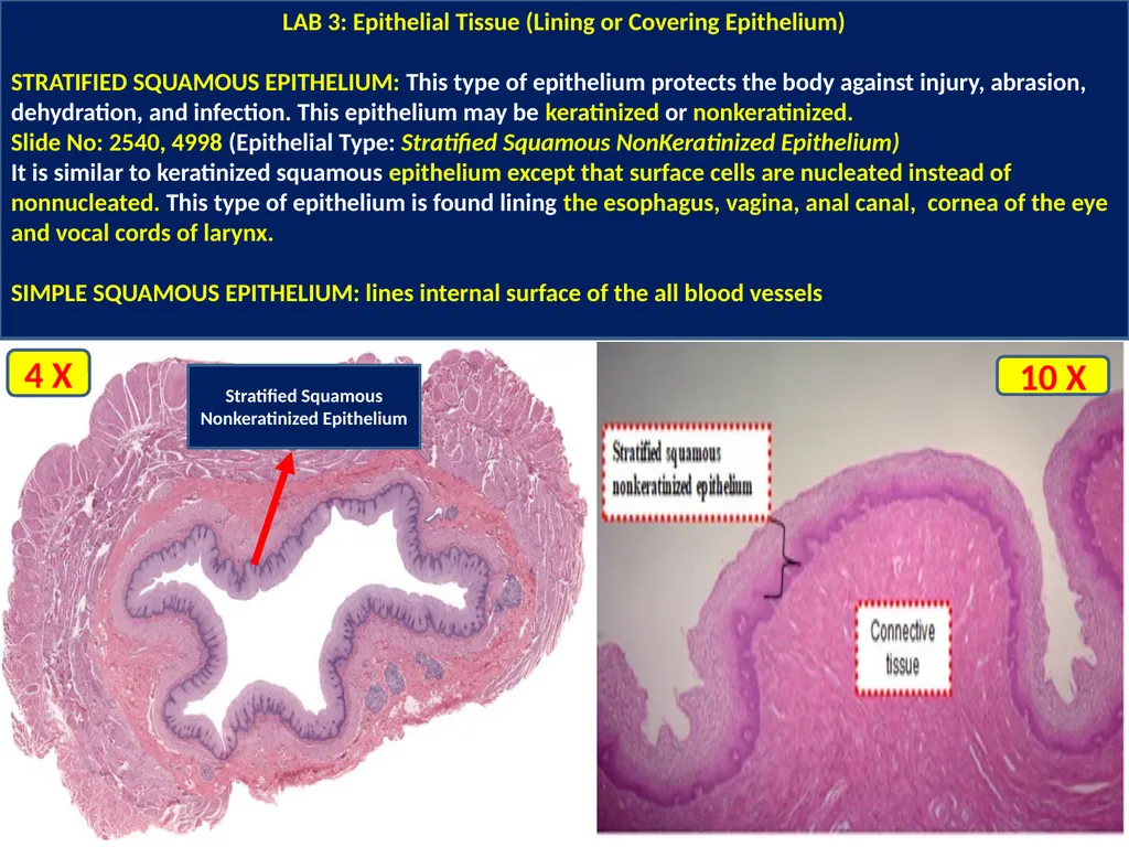LAB 3: Covering or Lining Epithelium: Lining - slide 2 of 6