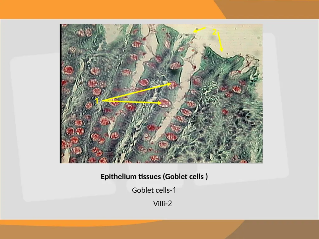 THE EPITHELIAL TISSUE Prepared by : Reem Aldossari - slide 14 of 15
