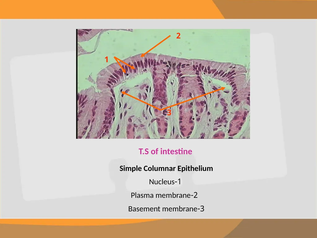 THE EPITHELIAL TISSUE Prepared by : Reem Aldossari - slide 13 of 15