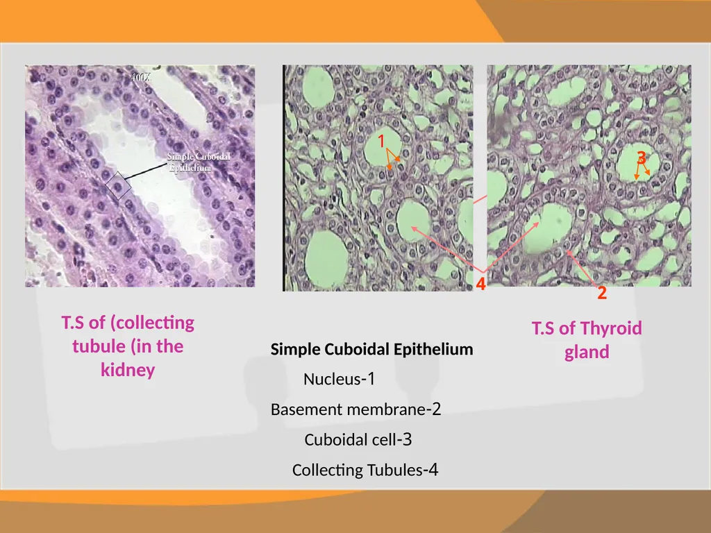 THE EPITHELIAL TISSUE Prepared by : Reem Aldossari - slide 12 of 15