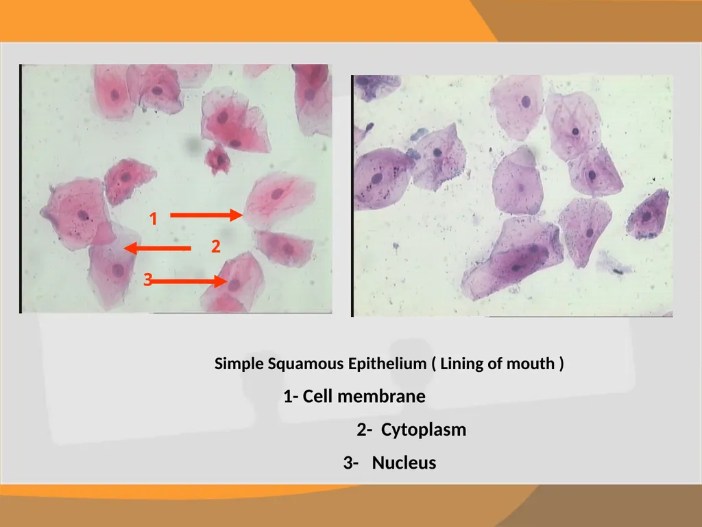 THE EPITHELIAL TISSUE Prepared by : Reem Aldossari - slide 11 of 15