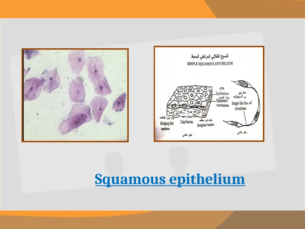 THE EPITHELIAL TISSUE Prepared by : Reem Aldossari - slide 6 of 15