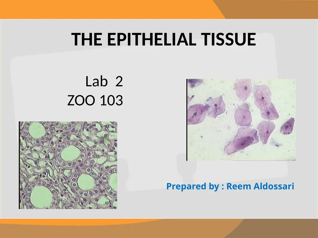 THE EPITHELIAL TISSUE Prepared by : Reem Aldossari - slide 1 of 15