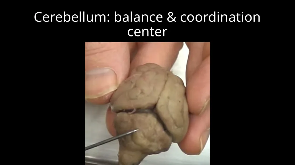 Brain Dissection Cerebrum: conscious thought & - slide 6 of 15