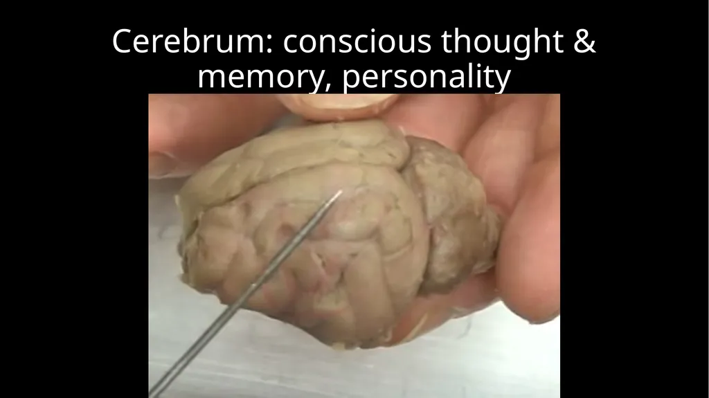Brain Dissection Cerebrum: conscious thought & - slide 2 of 15