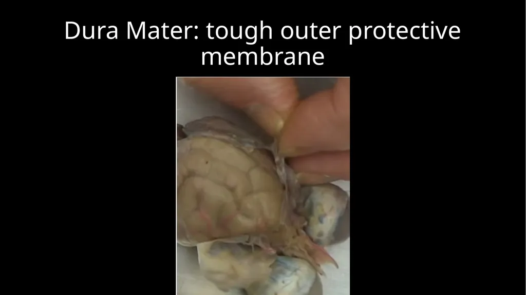 Brain Dissection Cerebrum: conscious thought & - slide 13 of 15