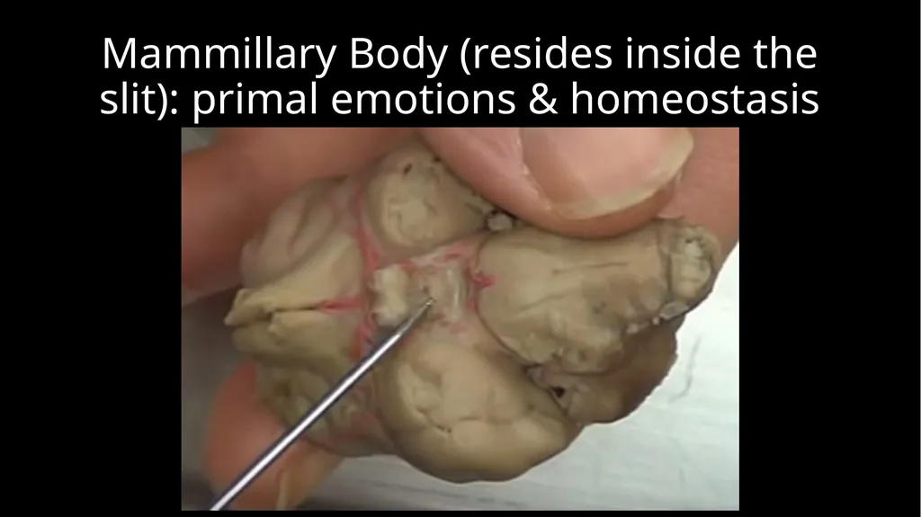 Brain Dissection Cerebrum: conscious thought & - slide 10 of 15