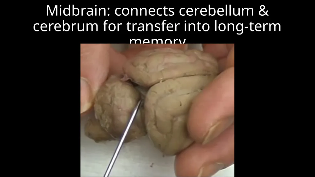 Brain Dissection Cerebrum: conscious thought & - slide 5 of 15