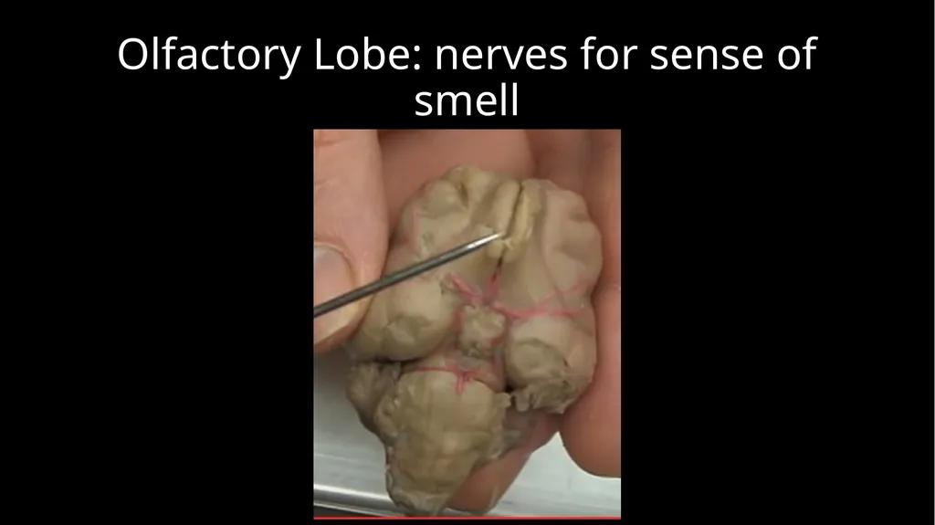 Brain Dissection Cerebrum: conscious thought & - slide 7 of 15