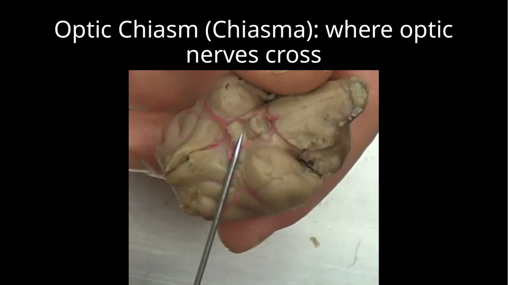 Brain Dissection Cerebrum: conscious thought & - slide 8 of 15