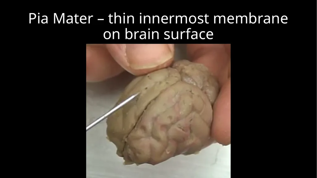 Brain Dissection Cerebrum: conscious thought & - slide 14 of 15