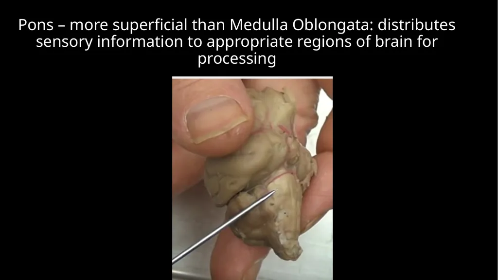 Brain Dissection Cerebrum: conscious thought & - slide 11 of 15