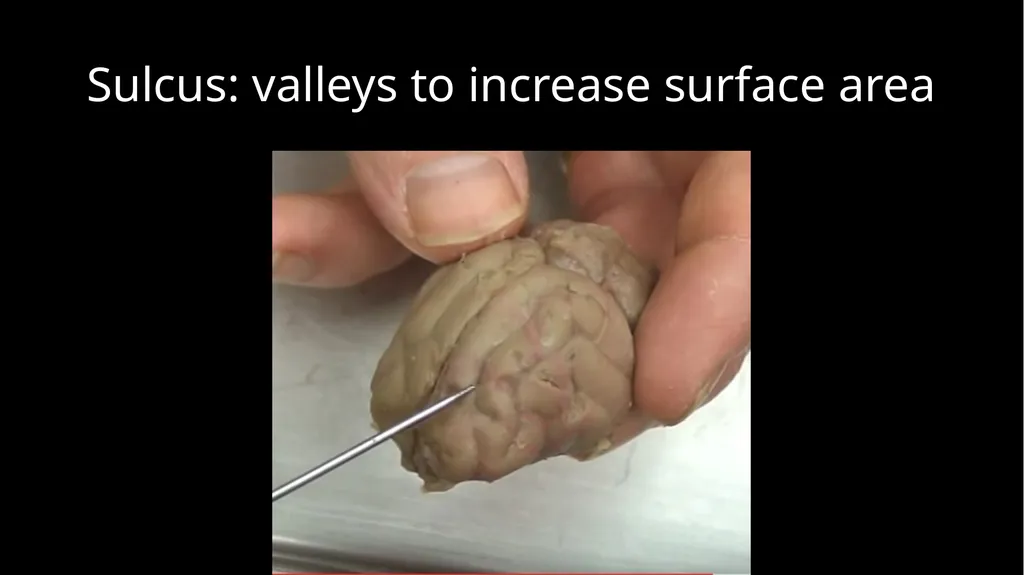 Brain Dissection Cerebrum: conscious thought & - slide 4 of 15