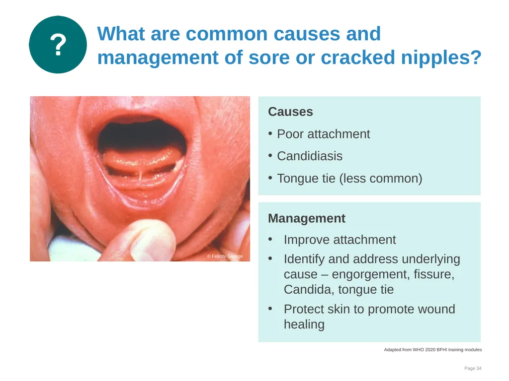 Breastfeeding: Overcoming difficulties Goal and - slide 34 of 51