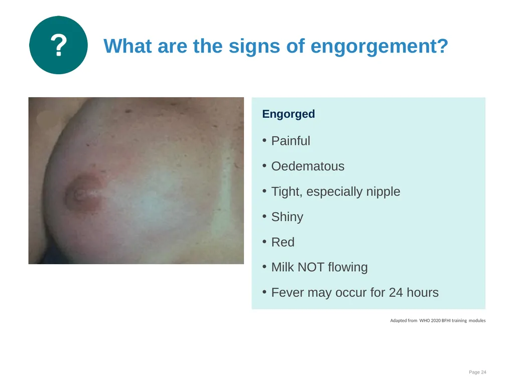 Breastfeeding: Overcoming difficulties Goal and - slide 24 of 51