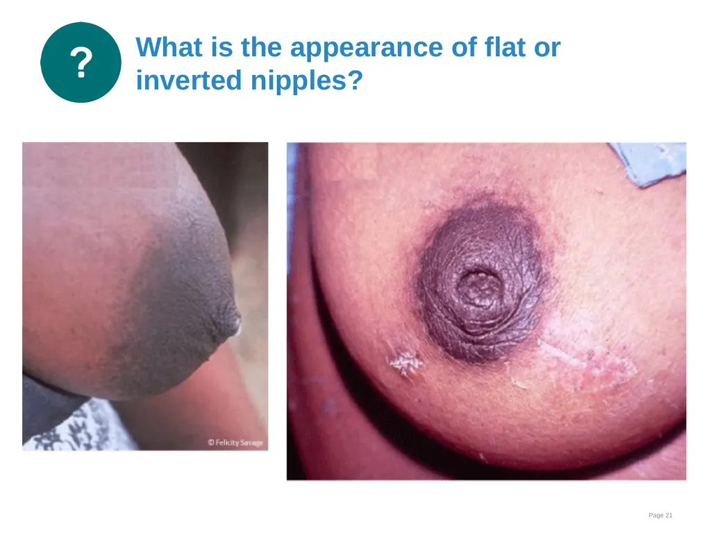 Breastfeeding: Overcoming difficulties Goal and - slide 21 of 51