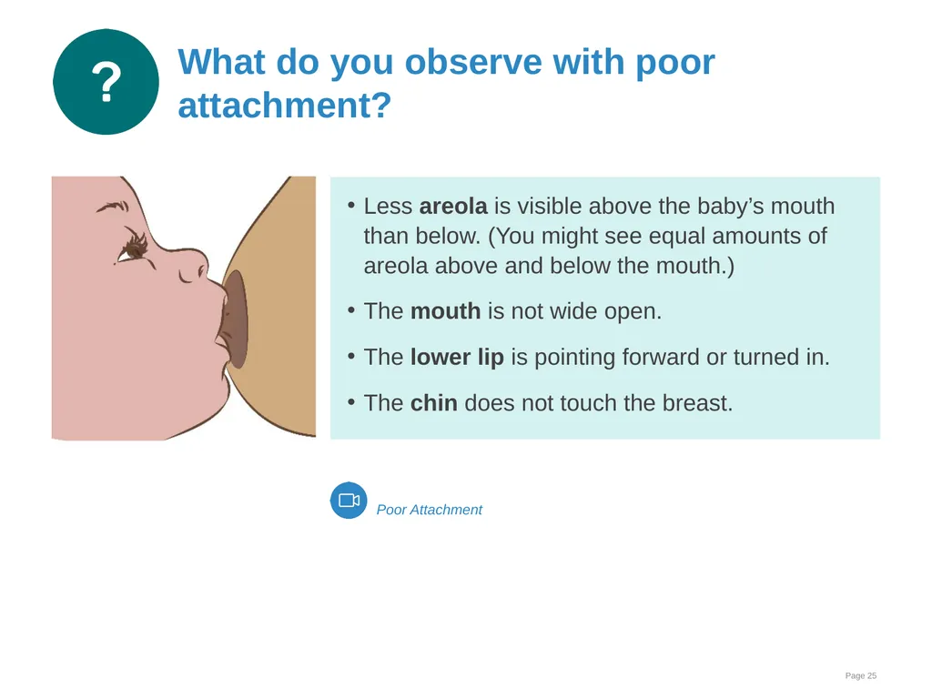Breastfeeding: Ensuring a good start - slide 25 of 44