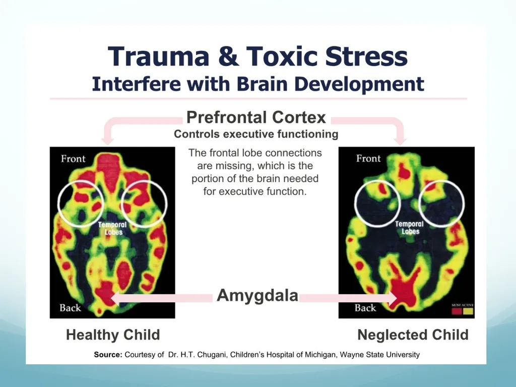 Understanding Adverse Childhood Experiences (ACEs) - slide 12 of 32