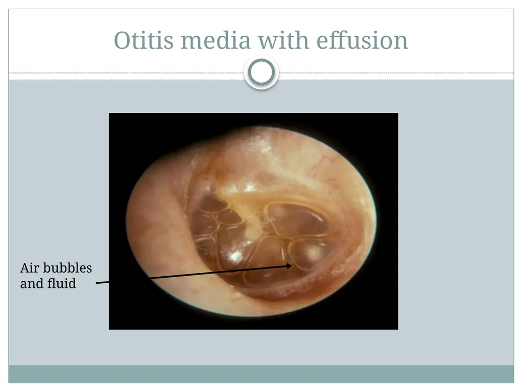This teaching presentation for the ISOM website - slide 11 of 17