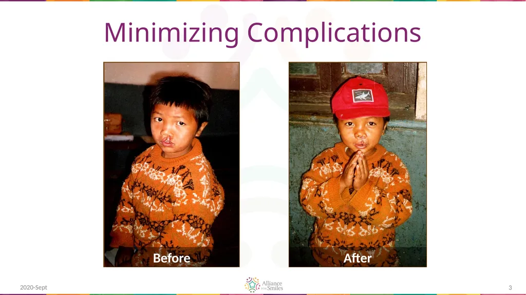 Care of Pediatric Cleft Lip and Palate Repair - slide 3 of 21