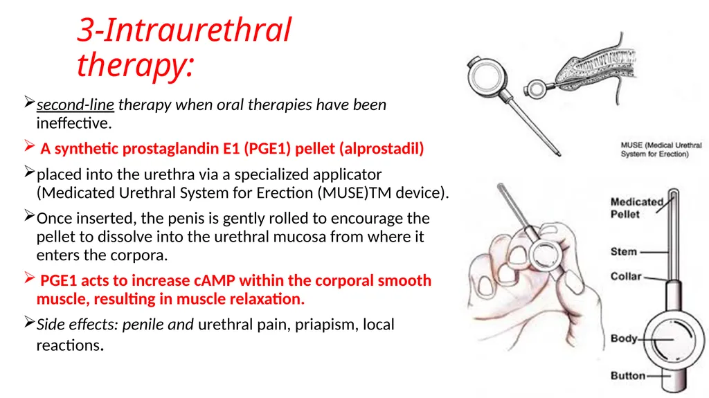 Anatomy of penis, and Physiology of erection, - slide 30 of 34