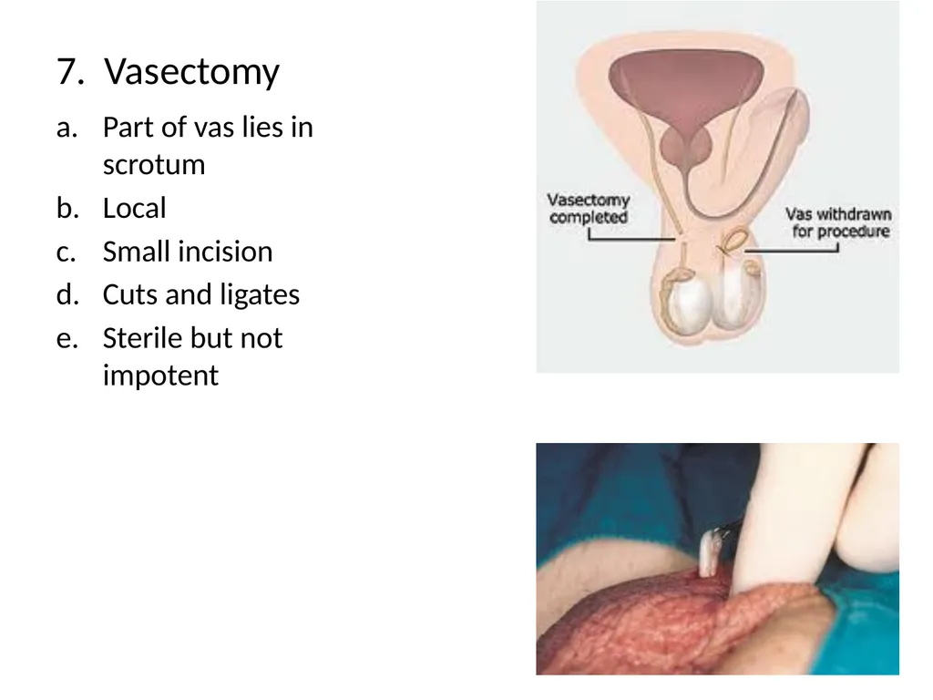 Reproductive Biology I. Need for Meiosis A. Human - slide 11 of 33